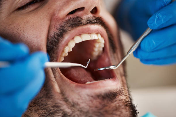 Best Emergency Broken Tooth Repair in Massac, KY